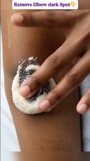 How to Remove Dark Spot from Your Elbow 👇👇#darkelbow #blackelbow #skincare #bodycare #beautytips
