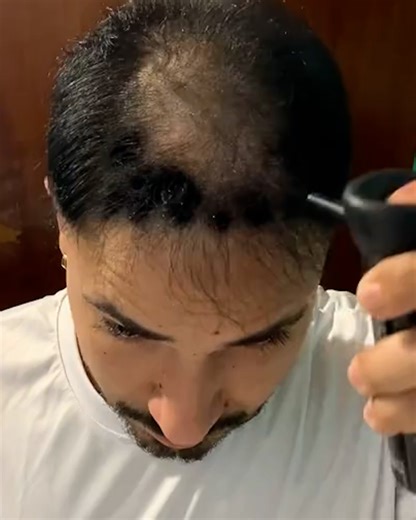 The latest in hair technology is here 🤯💈 | UNILAD Tech