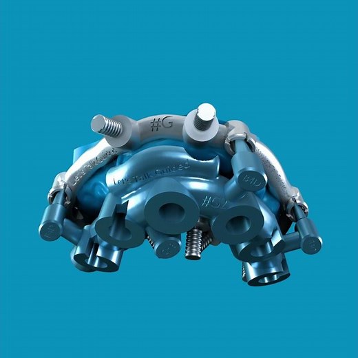 Stackable guides for [all-on-6 Anyridge | Megagen]