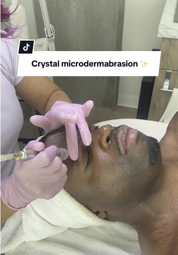 Crystal Microdermabrasion Benefits for Your Skin