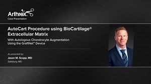 AutoCart™ Procedure for Symptomatic Cartilage Lesions