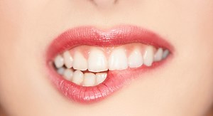 Aphtes : 10 remèdes maison pour les soulager naturellement