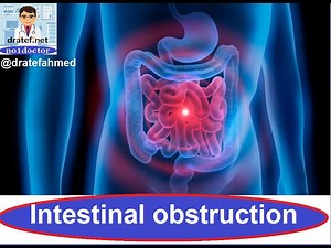 Intestinal obstruction / Case Presentation / Medical Case Study / Case Discussion/ Case Report