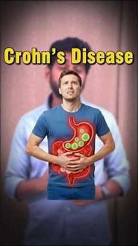 C for Crohn's Disease | Ayurvedic Root Cause Healing Explained | A to Z Ayurveda Series