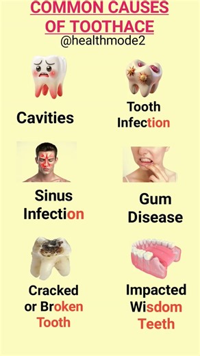 Common Causes of Toothache: 8 Reasons Your Teeth May Hurt#healthylifestyle#healthtips