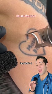 310K views · 1.2K reactions | How tattoo removal works #explained #tattooremoval #science #laser #cosmetic #doctor #ink | Doctor Myro | Facebook