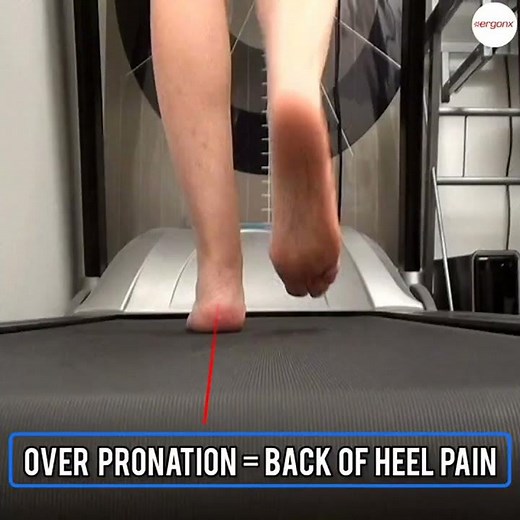 Fix Your Heel Pain: Discover the Truth About Foot Mechanics #HeelPain #FootHealth