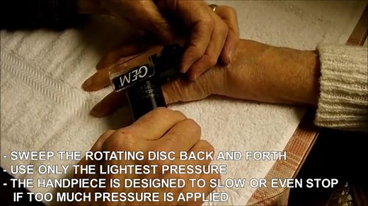 CLINICAL USE OF THE MOONEY RING CUTTING SYSTEM CAPTIONED (7)