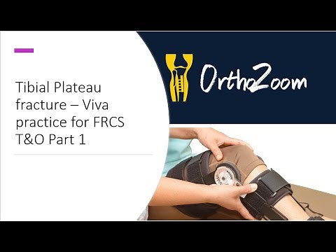 Tibial Plateau Fracture part 1 - viva Practice for FRCS T&O