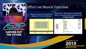 Lateralized Glenoids With Inlay Humerus Is the Way to Go