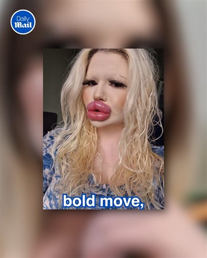 Lips filled to the limit 👄 | Daily Mail Video