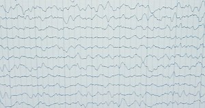 Electroencephalography On Paper Brain Research Analysis Stock Footage Video (100% Royalty-free) 1087038488 | Shutterstock