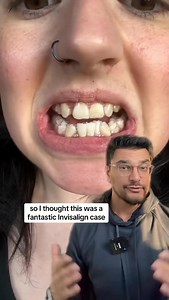 🦷 Invisalign vs. Braces — Overview 🔹 What They Are • Invisalign: A series of clear, removable plastic aligners custom-made to gradually move your teeth. ￼ • Braces: Fixed brackets and wires attached to your teeth that apply constant pressure to shift them into place. ￼ ⸻ 😁 Appearance • Invisalign: Nearly invisible — great if you want discreet treatment. ￼ • Braces: Visible metal (or ceramic) brackets — can be more noticeable, though ceramic braces are less so. ￼ Winner: Invisalign for subtlet