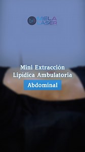 🔥 ¡Dile adiós a la grasa y luce un abdomen más definido en minutos! 🔥 Con M.E.L.A., eliminamos la grasa localizada de forma rápida, segura y sin cirugía. 💪 Marcación natural y armoniosa ⏳ Procedimiento en minutos, sin internamiento ✨ Resultados visibles desde el primer día 📲 Agenda tu consulta hoy y transforma tu figura sin esfuerzo. #AbdomenDefinido #TransformaciónRápida #MELA #ResultadosEnMinutos | Centro MELA Perú