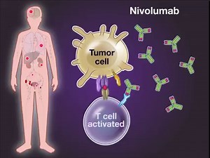 10K views · 197 reactions | Radical surgery, the standard of care in muscle-invasive urothelial carcinoma, is performed with curative intent, but more than 50% of patients have lethal metastatic recurrence. Adjuvant chemotherapy may prolong disease-free survival, but no consensus regarding routine therapy has emerged. New research findings are summarized in a short video. https://nej.md/2Rc0JTv | The New England Journal of Medicine | Facebook