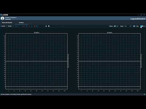 SGA | M3.4 - Logoaudiometría: Configuración y trazado de curvas