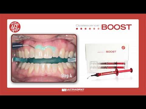 Ultradent Opalescence Boost Whitening