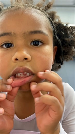 My daughters first busted lip in Jiu jitsu #mma #jiujitsu #wrestling #grappling #ufc #girls #athlete #fatherdaughter | Dominic Barry