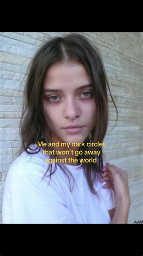How to Combat Dark Circles and Eye Bags Effectively