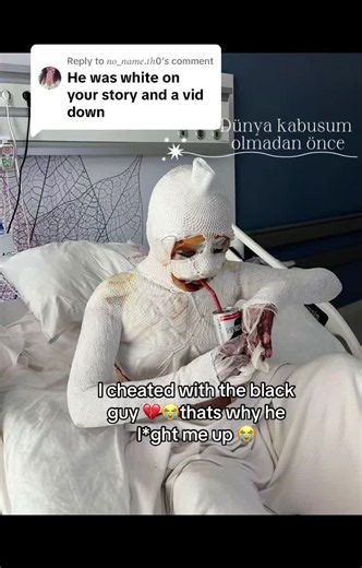 Replying to @𝑛𝑜_𝑛𝑎𝑚𝑒.𝑡ℎ0 I regretted 😭💔@UNCLE SCAR 💎 | white black guy