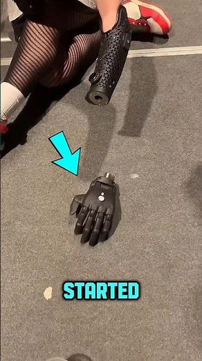 This Bionic Hand Can Changed The Future