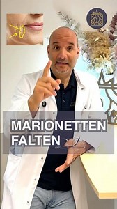 Treating marionette lines: Hyaluronic acid and botulinum toxin effectively combined