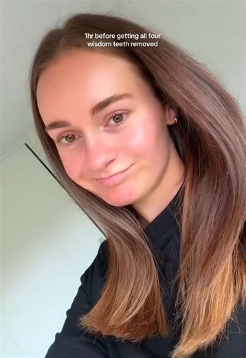 What to Expect After Wisdom Teeth Removal: A Journey