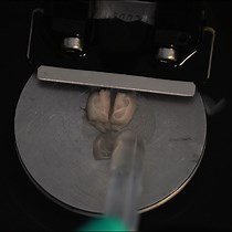 Video: Preparation of Acute Slices from Dorsal Hippocampus for Whole-Cell Recording and Neuronal Reconstruction in the Dentate Gyrus of Adult Mice