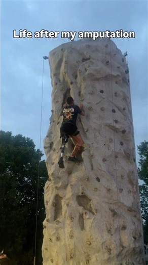 Life after being amputated, it’s all about your mindset! #motivation #inspiration #inspiration