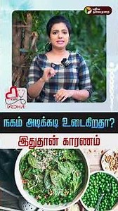 நகம் அடிக்கடி உடைகிறதா? இதுதான் காரணம் | Healthy Talks With Vedha | Health Care | Health Tips