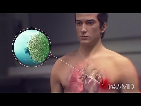 How Does Immunotherapy Fight Cancer? | WebMD