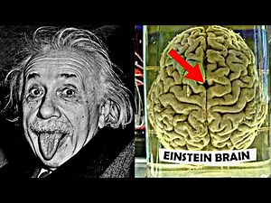 How Einstein's Brain was Different ?