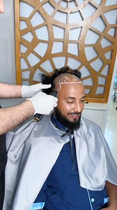 5.5K reactions · 170 shares | Evergreen Medical spa Best Hair transplant wow 0938860000/0115 62 13 68/ 09 20 52 60 52 #hairstyle | Samson Mekonnen Leta | Facebook