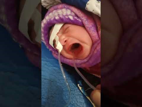 Newborn baby suction process lot of crying in after immediately birth newborn baby cover with relli