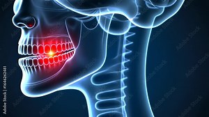 Dental pain, toothache relief, gum inflammation. Oral health. Gums swell during infection onset. Tooth decay causes severe pain. Dental hygiene prevents tooth loss.
