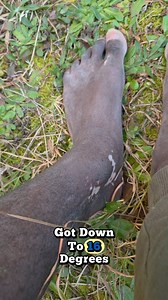 1 year update on my burn scars a cure to my winter time ashyness - Jabaroma.com | Naturejab