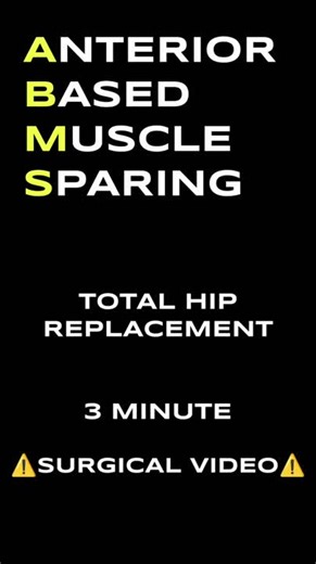 A total hip replacement (THR) is a surgical procedure in which a damaged or worn-out hip joint is replaced with an artificial prosthesis. This surgery is typically recommended for patients suffering… | Sasun Ravishka