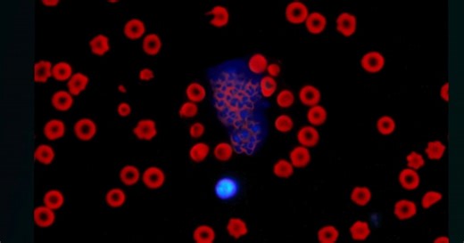 47 reactions · 15 shares | Did you hear? A slide-free, load-and-go workflow is coming. Learn more about the IDEXX inVue Dx™ Cellular Analyzer: https://bit.ly/inVueDx_cellularanalyzer | IDEXX | Facebook