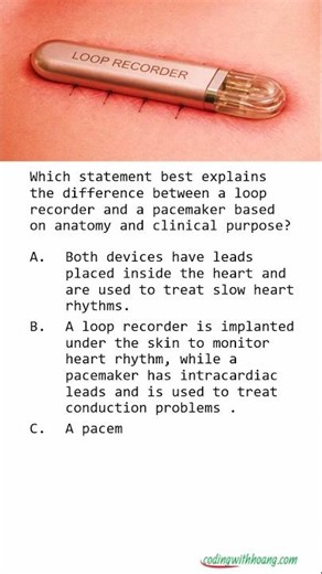 Loop Recorder vs Pacemaker: Know the Difference
