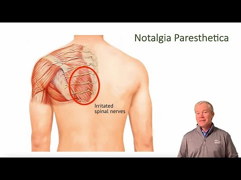 Notalgia Paresthetica | ChiroUp
