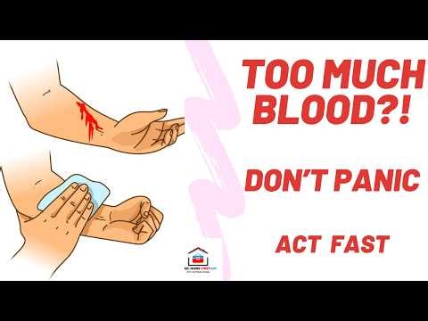 Bleeding Emergency: What You Must Do