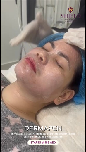 Erase your skin’s dull history and start a new chapter of radiance! Over time, your skin collects memories such as sun damage, acne scars, fine lines, and uneven tone. With Dermapen microneedling, your skin begins a natural healing journey, stimulating collagen, tightening pores, and revealing a fresh, youthful glow from within. Smooth, bright, and rejuvenated, your skin deserves this restart. Book your session today and rediscover your glow: Shield Medical Center – Abu Dhabi 058 542 7977 | 02 6