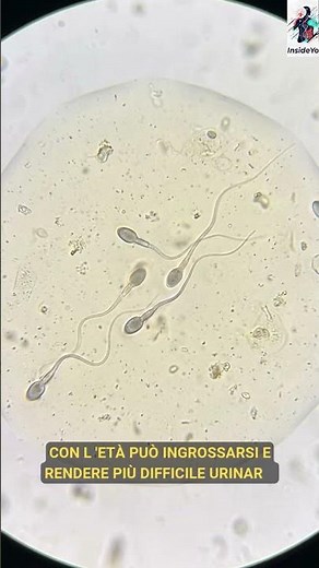 WHAT IS THE PROSTATE? #biology #curiosities #funfacts