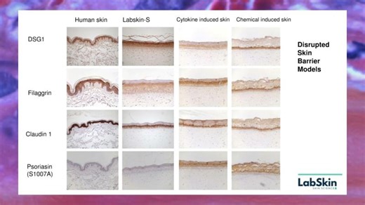 Modelling Atopic Dermatitis in the Lab – A New 3D Human Skin Model from Labskin | Dr Stewart Sale