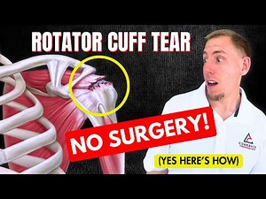 Can You Heal a Rotator Cuff Tear Without Surgery? (YES—Here’s How)