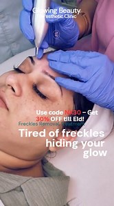 369 reactions · 12 shares | ✨ Say goodbye to freckles – for good! ...