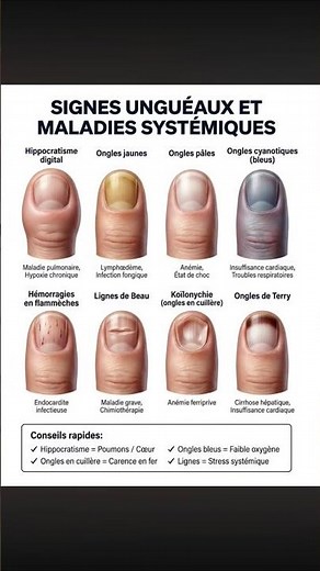 SIGNES UNGUEAUX ET MALADIES SYSTEMIQUES