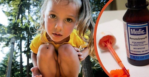 Mercurochrome, A Parent's Favorite Antiseptic And Kid's Nightmare, Won't Be Around Anymore