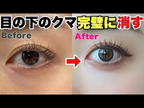 A Thorough Explanation on the Best Way to Hide Dark Circles Under the Eyes!