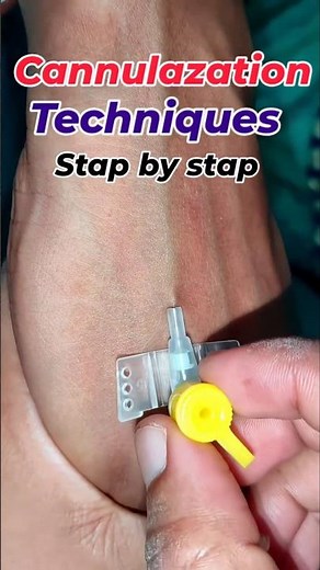 IV Cannulation Techniques Step by Step | Nursing Skill Tutorial #cannulation #nursingstudent #nurse